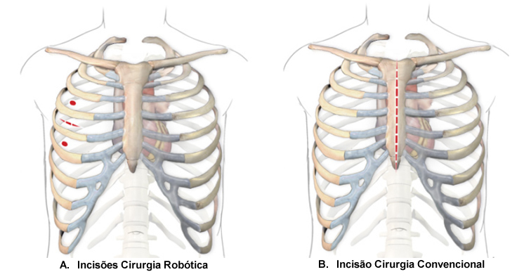 img-cirurgia-minimamente-invasiva3