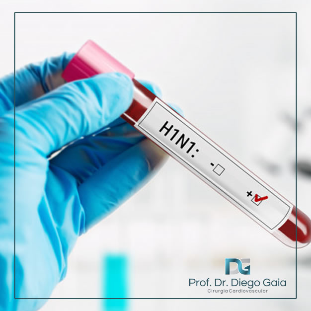 Tratamento da Pneumonia por H1N1. ECMO - Extracorporeal Membrane Oxigenator (Oxigenador de Membrana Extracorpórea)