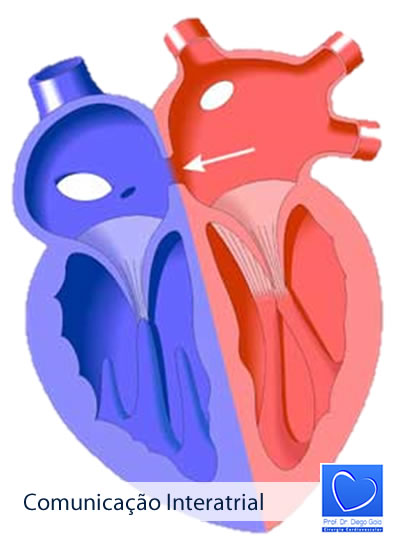 Comunicacao Interatrial