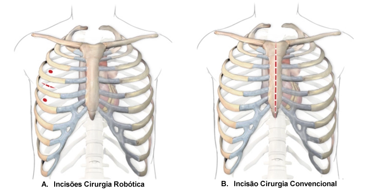 VIDEOGIN  Cirurgia Minimamente Invasiva