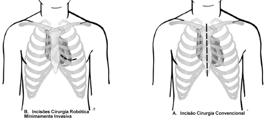 img-cirurgia-minimamente-invasiva4